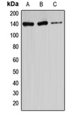 Western blot analysis of HeLa (Lane 1), U87MG (Lane 2), Jurkat (Lane 3) whole cell lysates using ATXN2 antibody