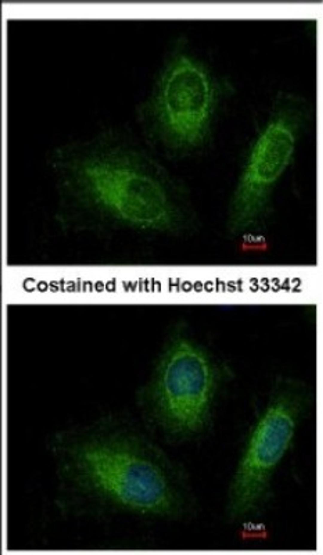 Immunocytochemistry/Immunofluorescence: Rab20 Antibody [NBP2-20039] - Immunofluorescence analysis of methanol-fixed HeLa, using antibody at 1:200 dilution.