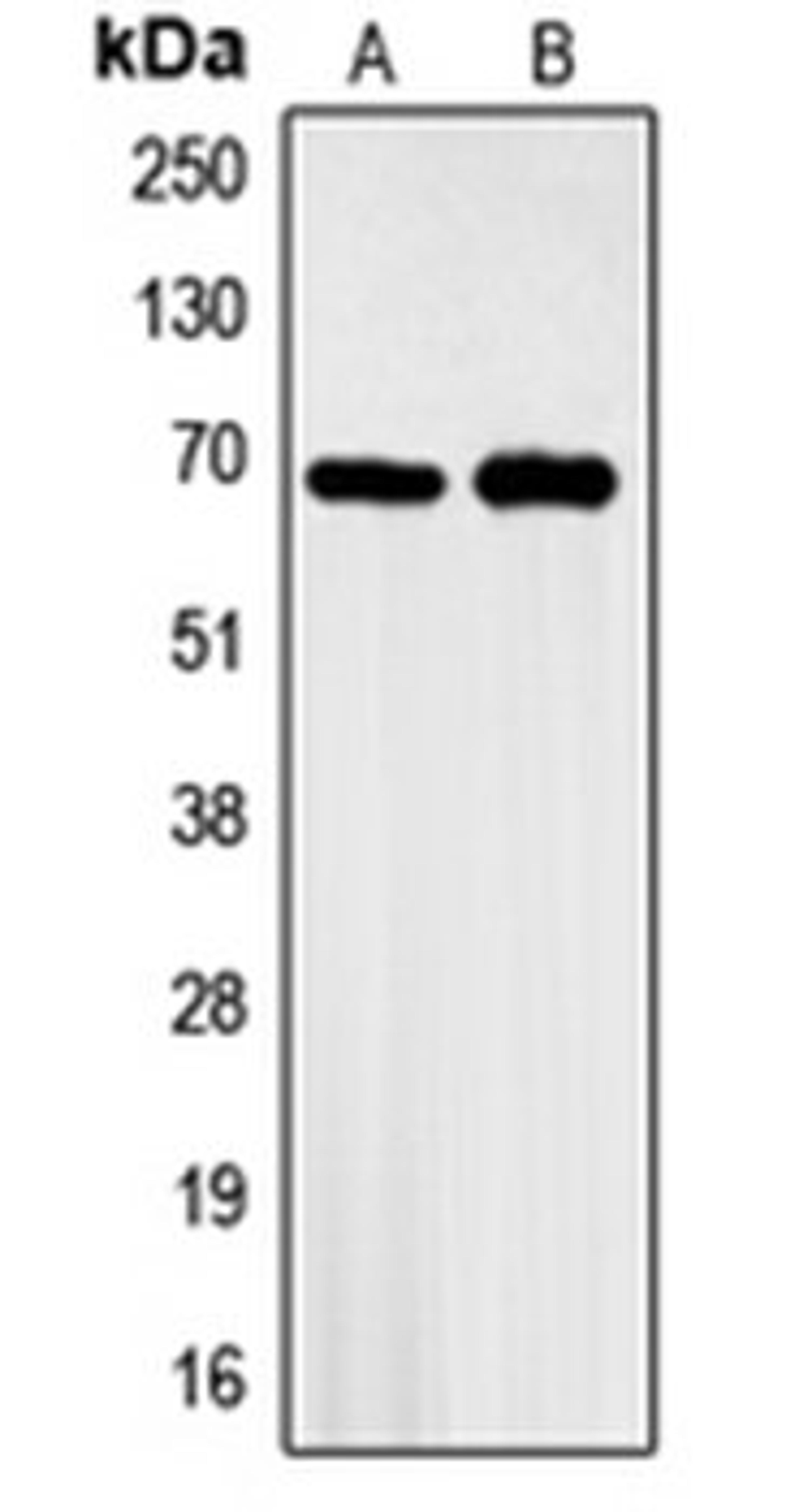 Western blot analysis of A549 (Lane 1), HeLa (Lane 2) whole cell lysates using GBP3 antibody