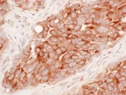 Detection of human Reticulon-3 by immunohistochemistry.