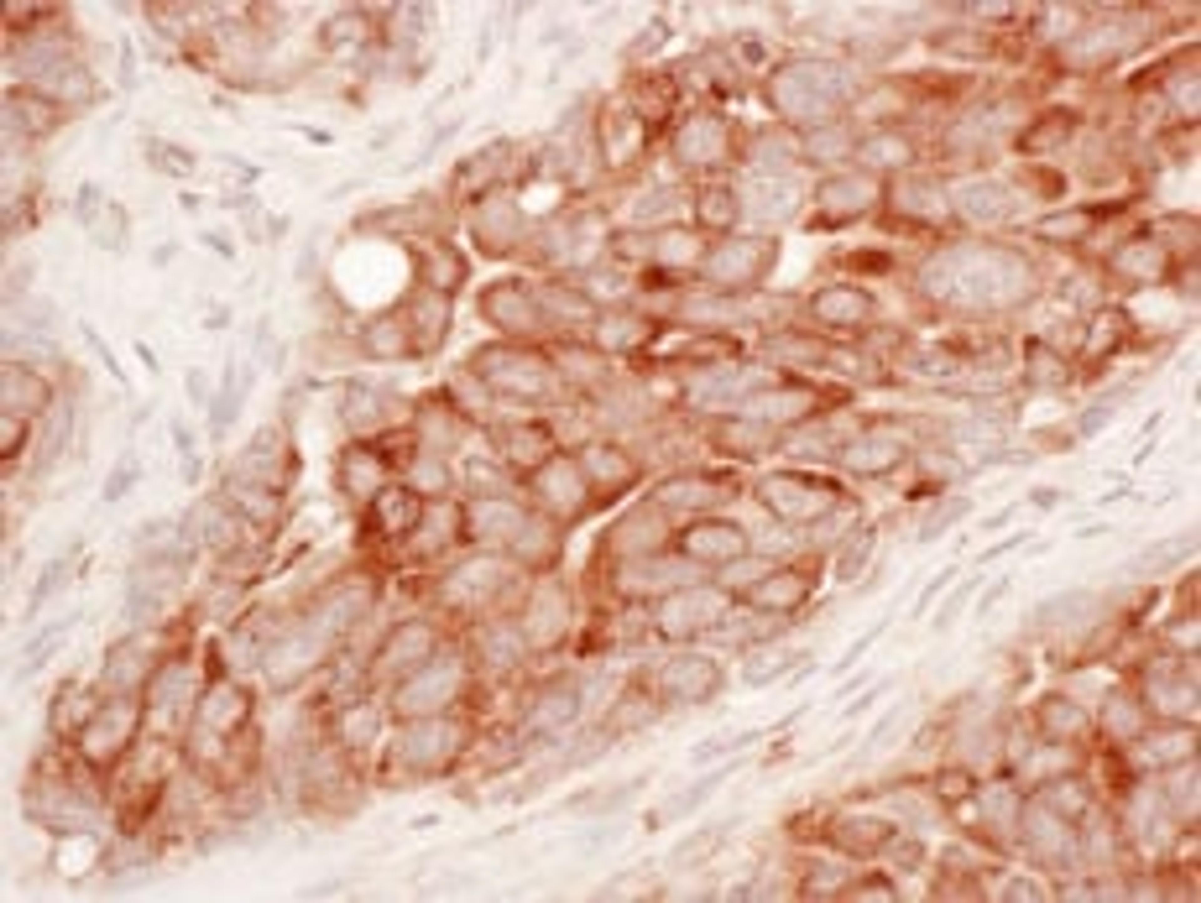 Detection of human Reticulon-3 by immunohistochemistry.