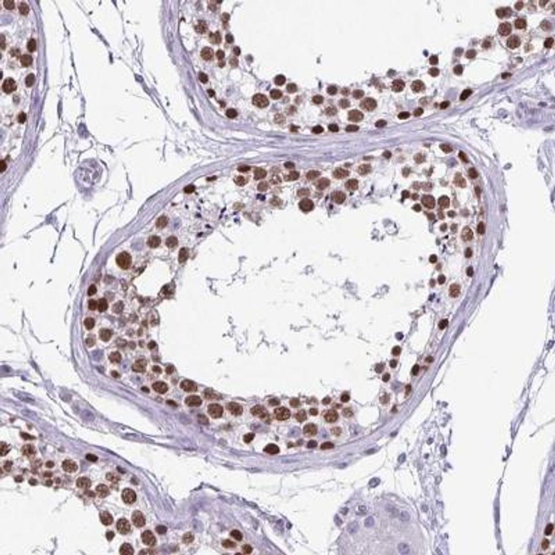 Immunohistochemistry: VCX Antibody [NBP2-46770] - Analysis of human testis shows strong nuclear positivity in cells in seminiferous ducts.