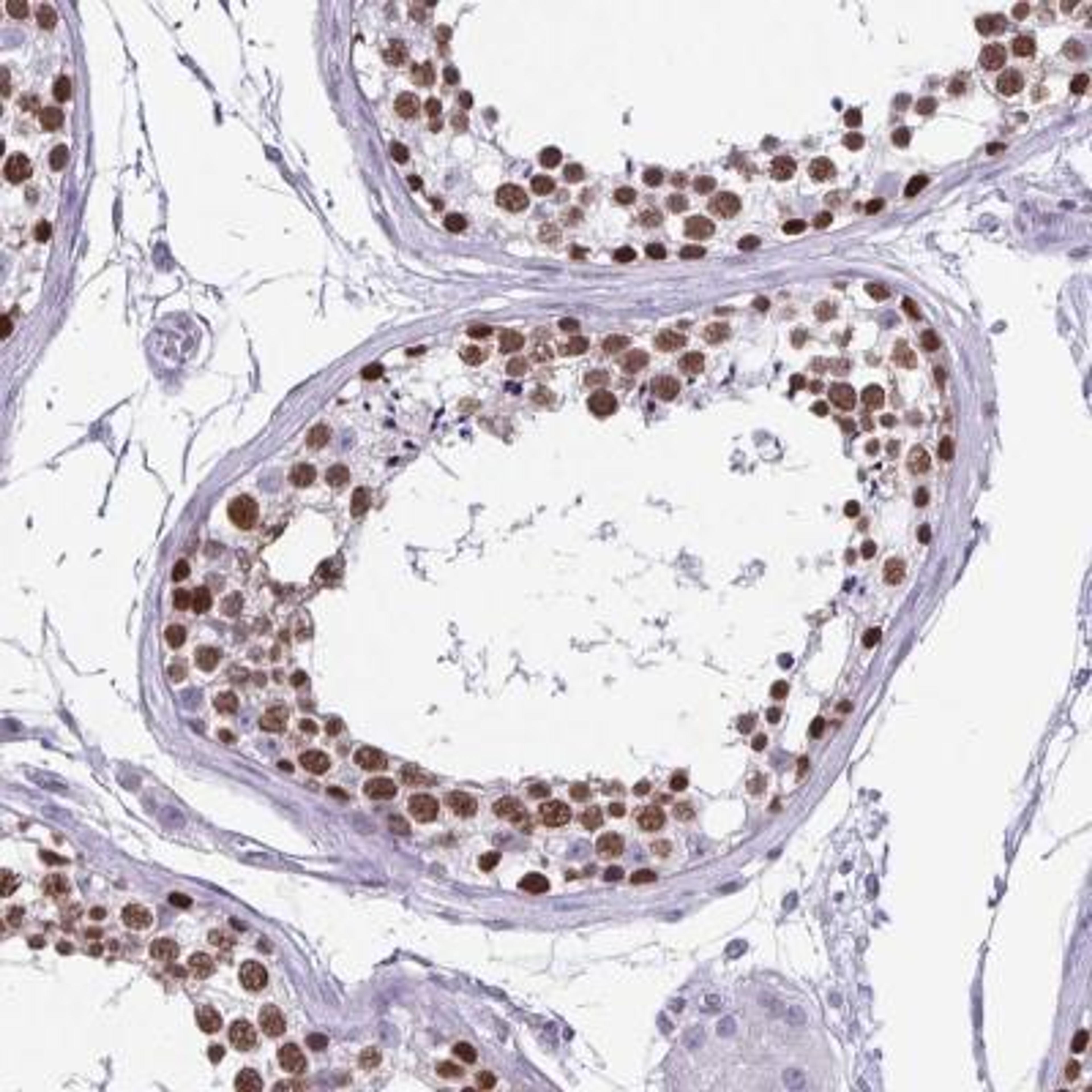 Immunohistochemistry: VCX Antibody [NBP2-46770] - Analysis of human testis shows strong nuclear positivity in cells in seminiferous ducts.