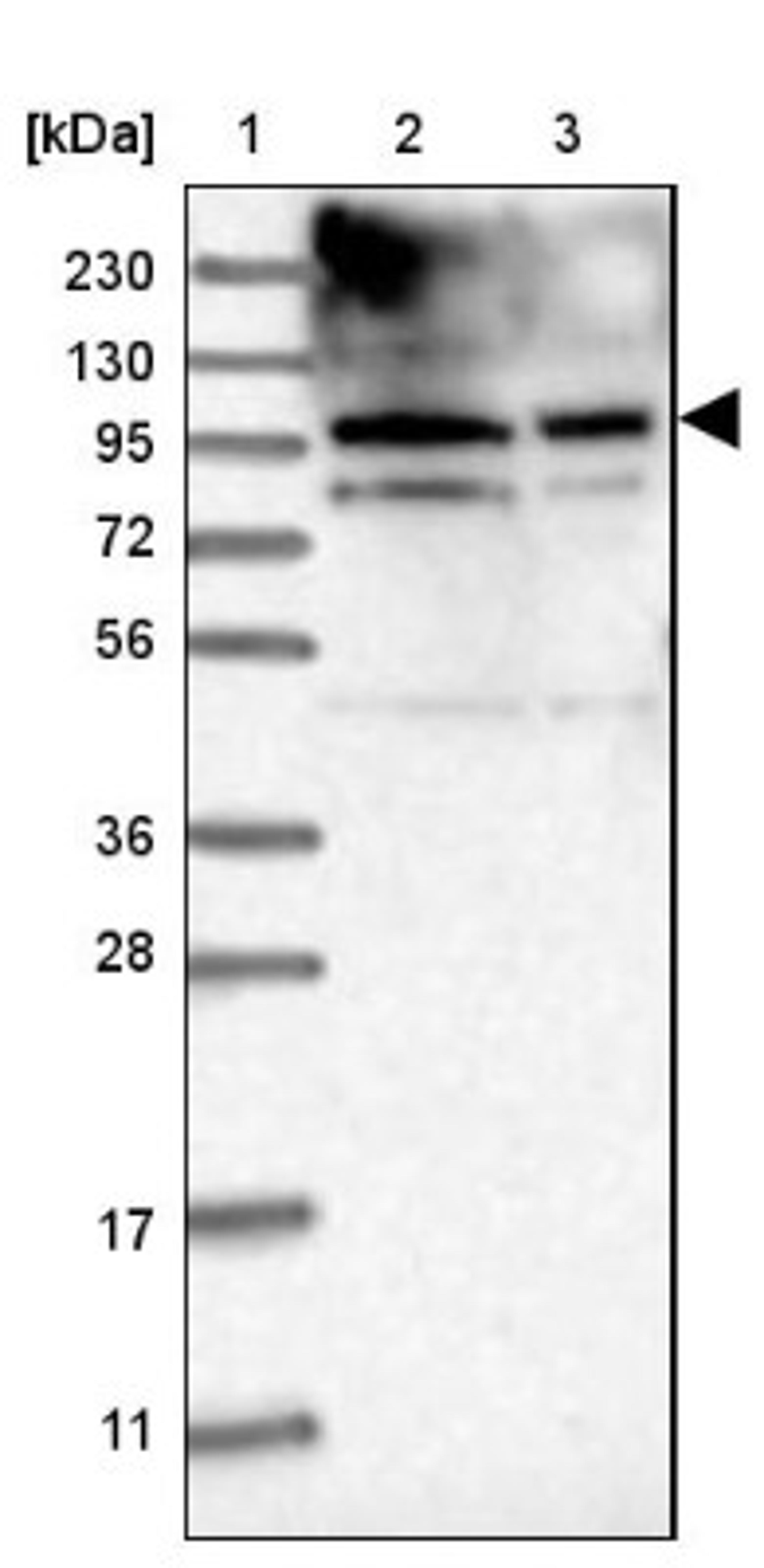 Western Blot: GPRIN1 Antibody [NBP1-83330] - Lane 1: Marker [kDa] 230, 130, 95, 72, 56, 36, 28, 17, 11<br/>Lane 2: Human cell line RT-4<br/>Lane 3: Human cell line U-251MG sp