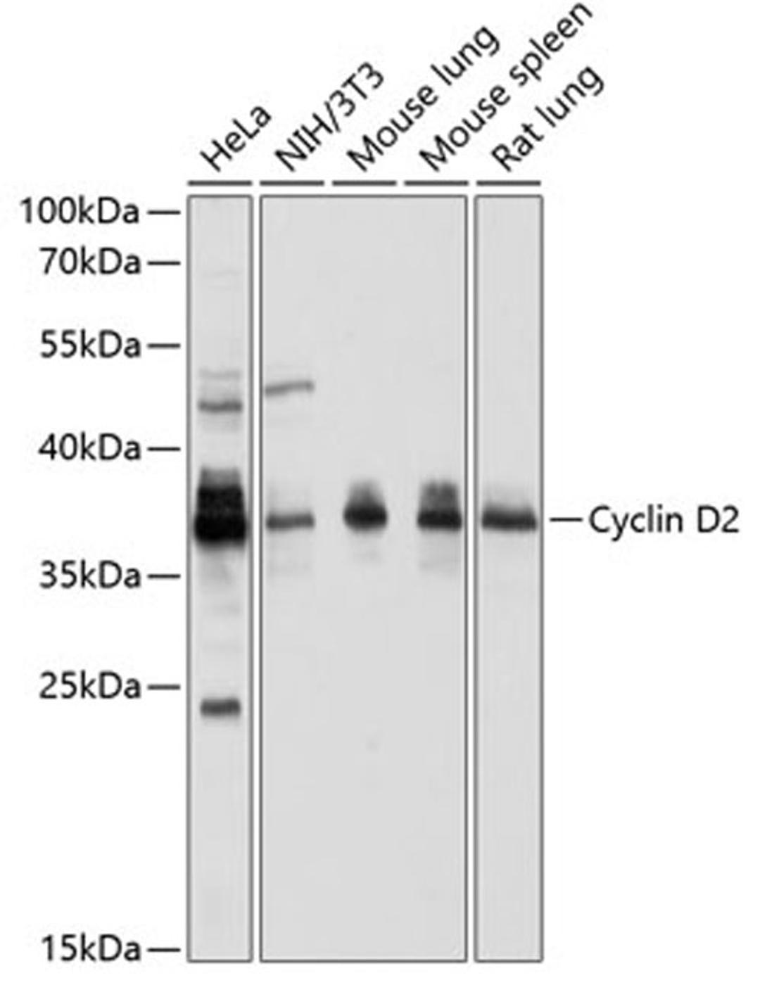 Western blot - Cyclin D2 antibody (A1773)