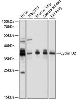 Western blot - Cyclin D2 antibody (A1773)