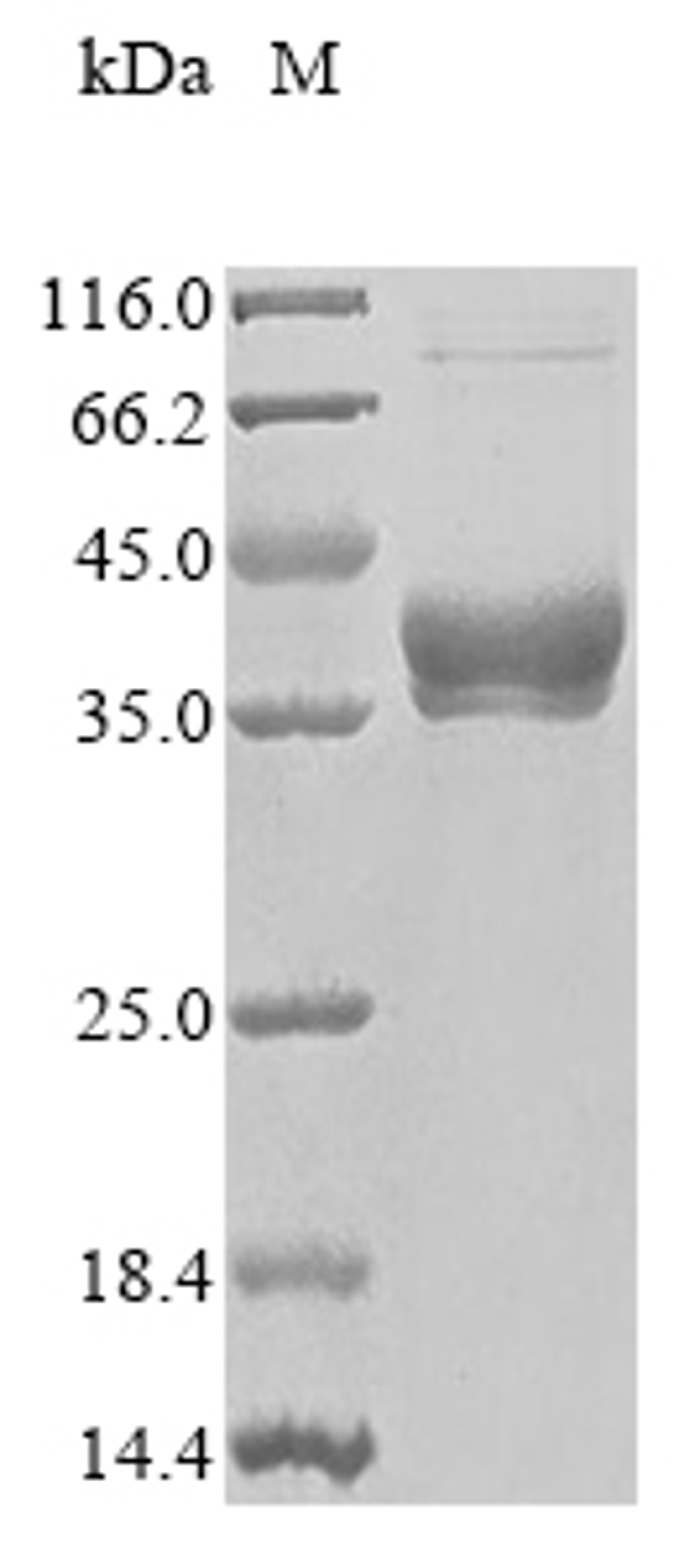 (Tris-Glycine gel) Discontinuous SDS-PAGE (reduced) with 5% enrichment gel and 15% separation gel.
