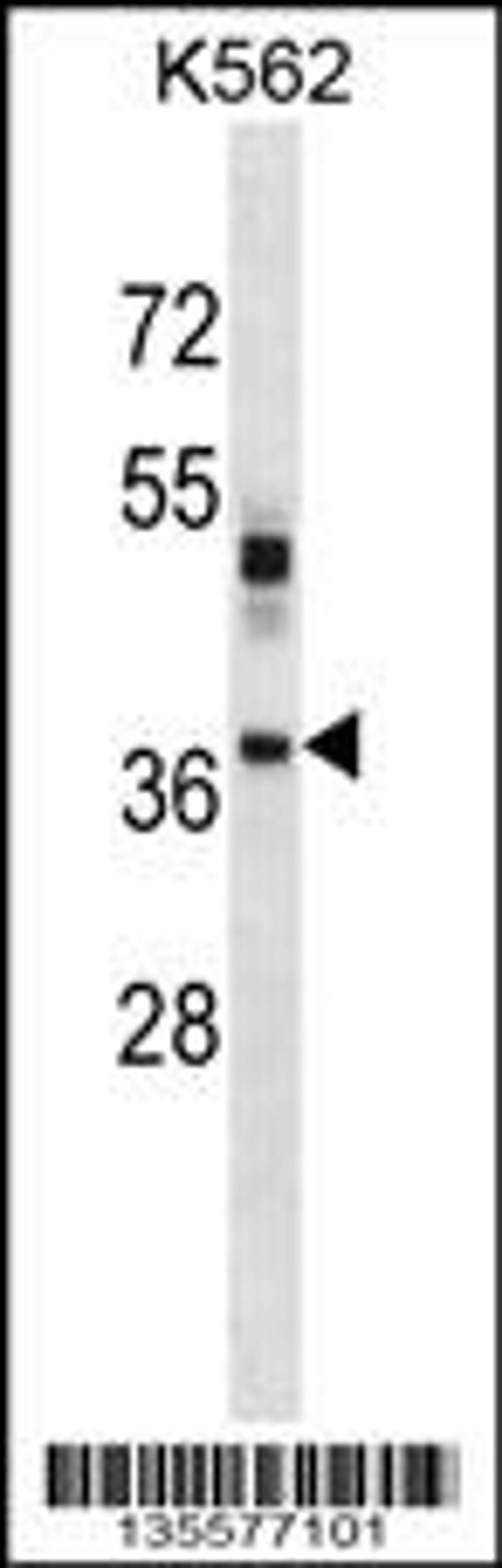 Western blot analysis in K562 cell line lysates (35ug/lane).