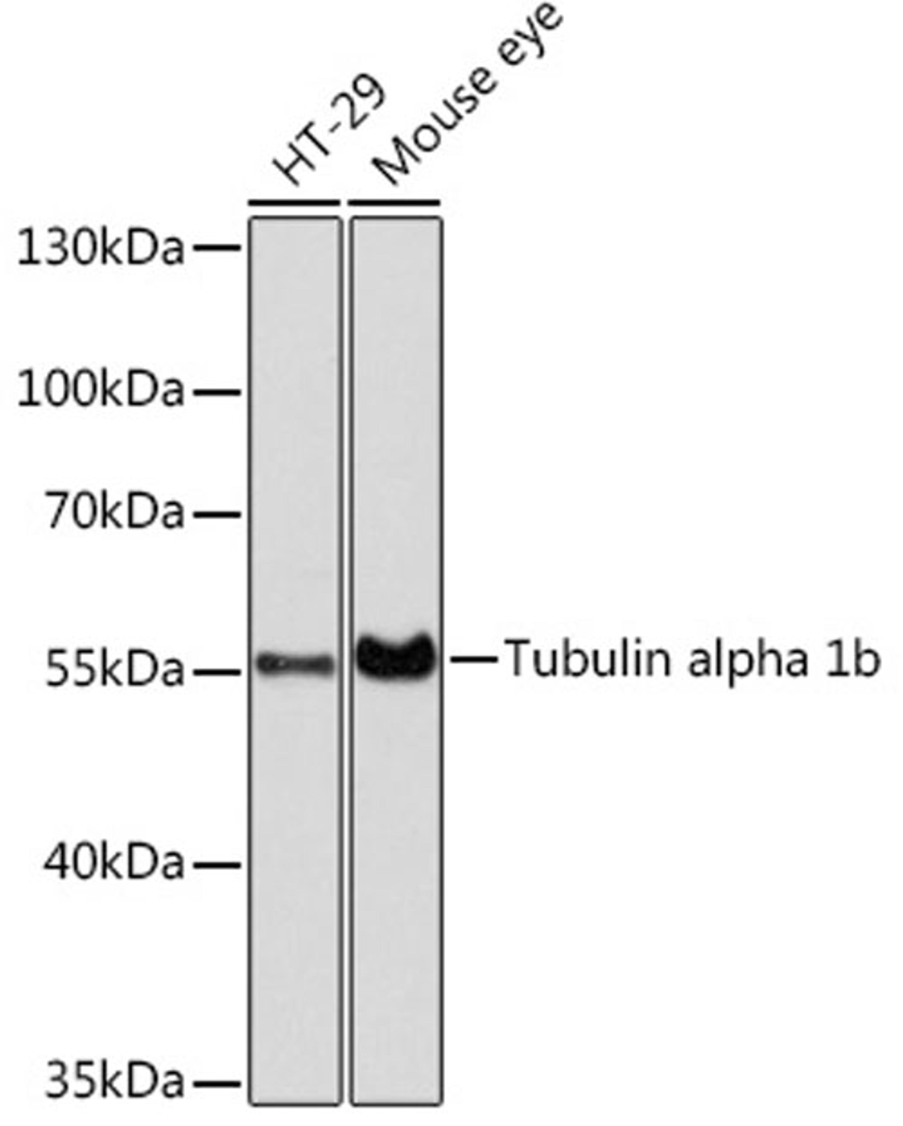 Western blot - Tubulin alpha 1b antibody (AC025)