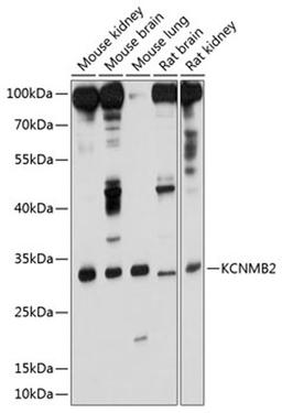 Western blot - KCNMB2 antibody (A10277)