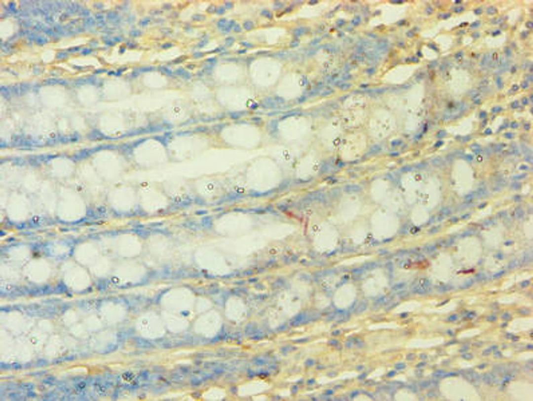 Immunohistochemistry of paraffin-embedded human colon tissue using CSB-PA015624EA01HU at dilution of 1:50