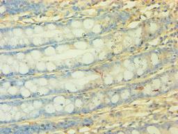 Immunohistochemistry of paraffin-embedded human colon tissue using CSB-PA015624EA01HU at dilution of 1:50