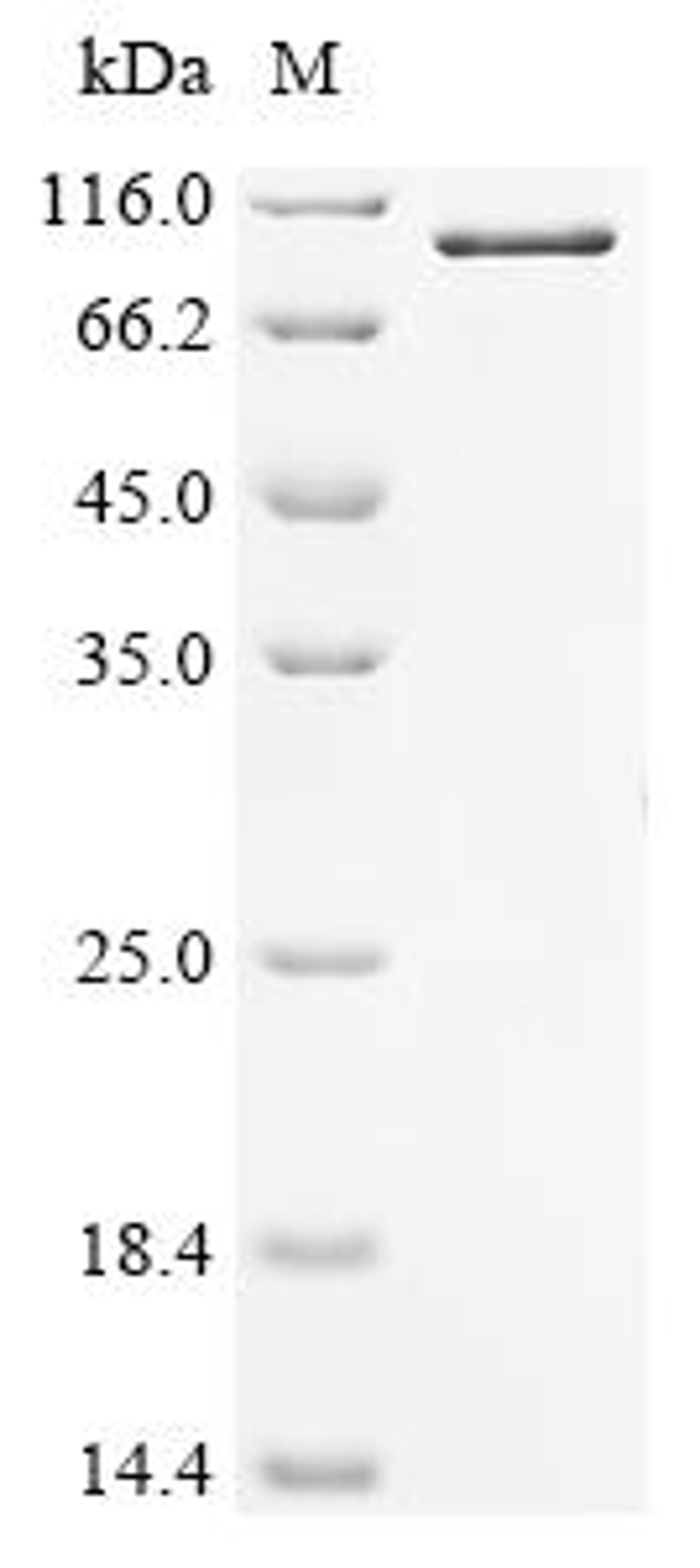 (Tris-Glycine gel) Discontinuous SDS-PAGE (reduced) with 5% enrichment gel and 15% separation gel.