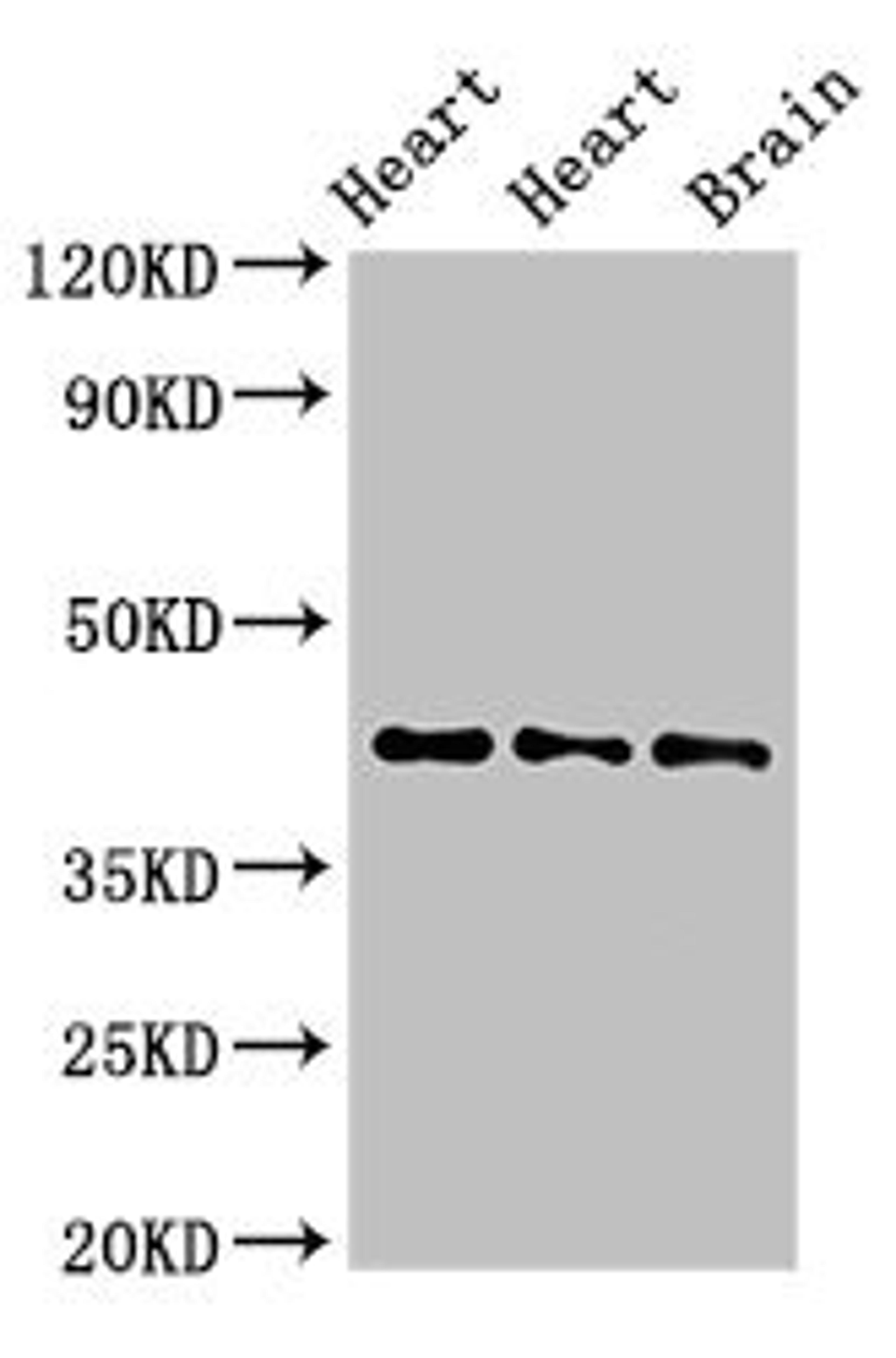 Western Blot. Positive WB detected in: Rat heart tissue, Mouse heart tissue, Mouse brain tissue. All lanes: NPSR1 antibody at 4ug/ml. Secondary. Goat polyclonal to rabbit IgG at 1/50000 dilution. Predicted band size: 43, 36, 45, 44, 42, 19, 16, 17, 11 kDa. Observed band size: 43 kDa.
