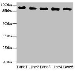 Western blot. All lanes: COPB2 antibody at 2.51ug/ml. Lane 1: Human placenta tissue. Lane 2: MCF-7 whole cell lysate. Lane 3: Hela whole cell lysate. Lane 4: HepG2 whole cell lysate. Lane 5: Jurkat whole cell lysate. Secondary. Goat polyclonal to rabbit IgG at 1/10000 dilution. Predicted band size: 103, 100 kDa. Observed band size: 103 kDa.