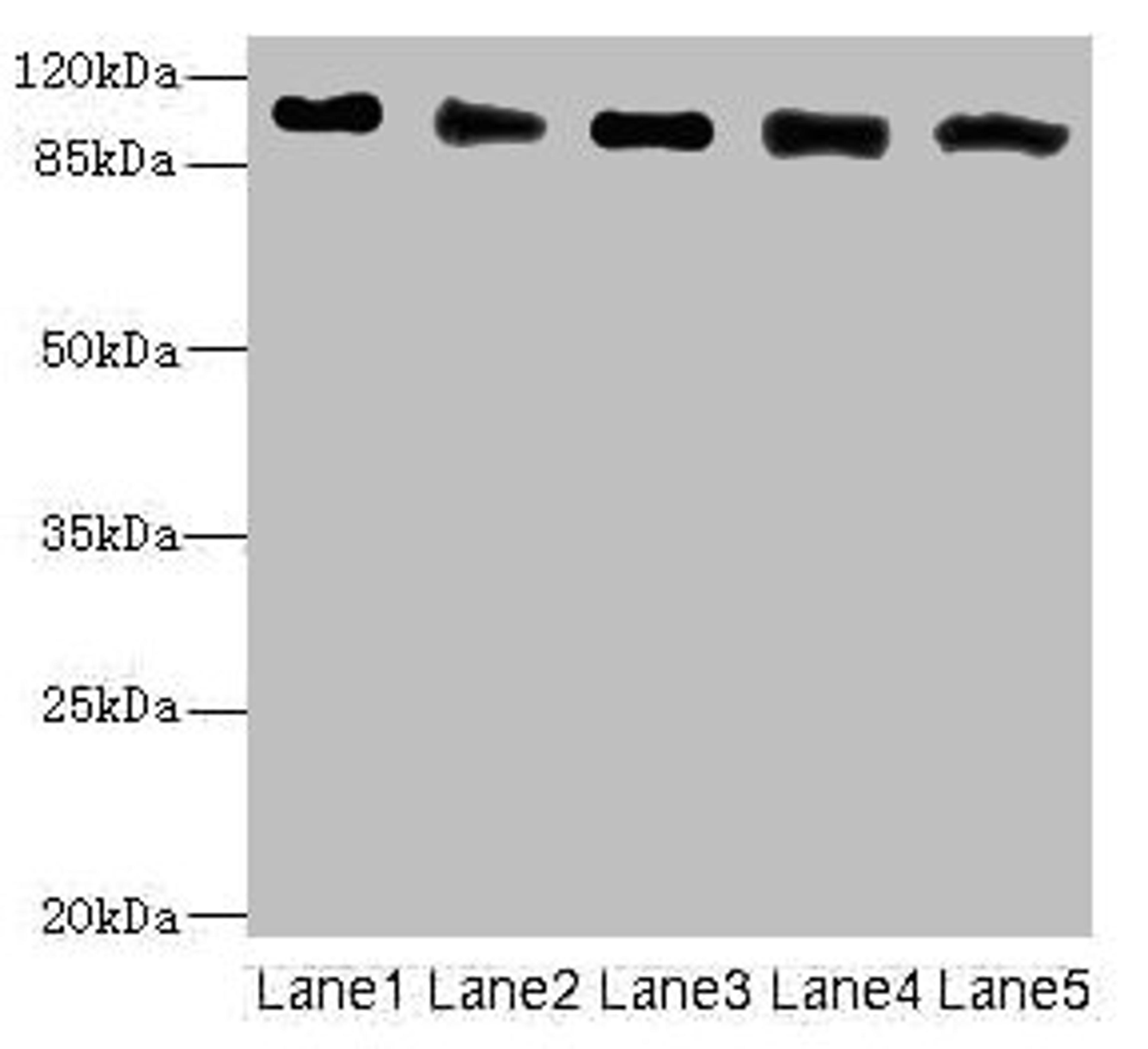 Western blot. All lanes: COPB2 antibody at 2.51ug/ml. Lane 1: Human placenta tissue. Lane 2: MCF-7 whole cell lysate. Lane 3: Hela whole cell lysate. Lane 4: HepG2 whole cell lysate. Lane 5: Jurkat whole cell lysate. Secondary. Goat polyclonal to rabbit IgG at 1/10000 dilution. Predicted band size: 103, 100 kDa. Observed band size: 103 kDa.