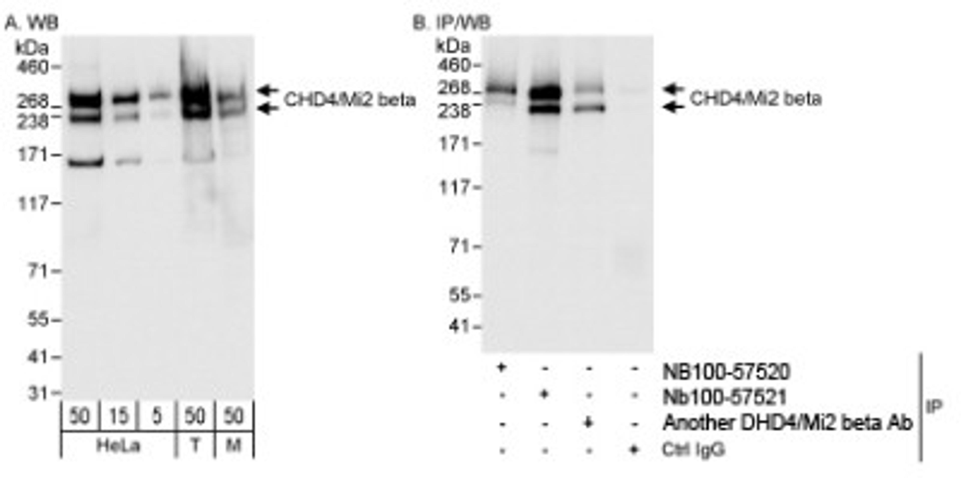 Western Blot: CHD4 Antibody [NB100-57521] - Detection of Human and Mouse CHD4/Mi2 beta on HeLa whole cell lysate using Nb100-57521. CHD4/Mi2 beta was also immunoprecipitated by Nb100-57520 and another anti-CHD4/Mi2 beta.