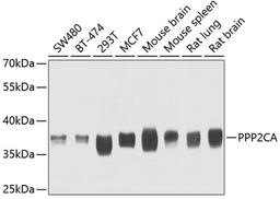 Western blot - PPP2CA antibody (A6702)