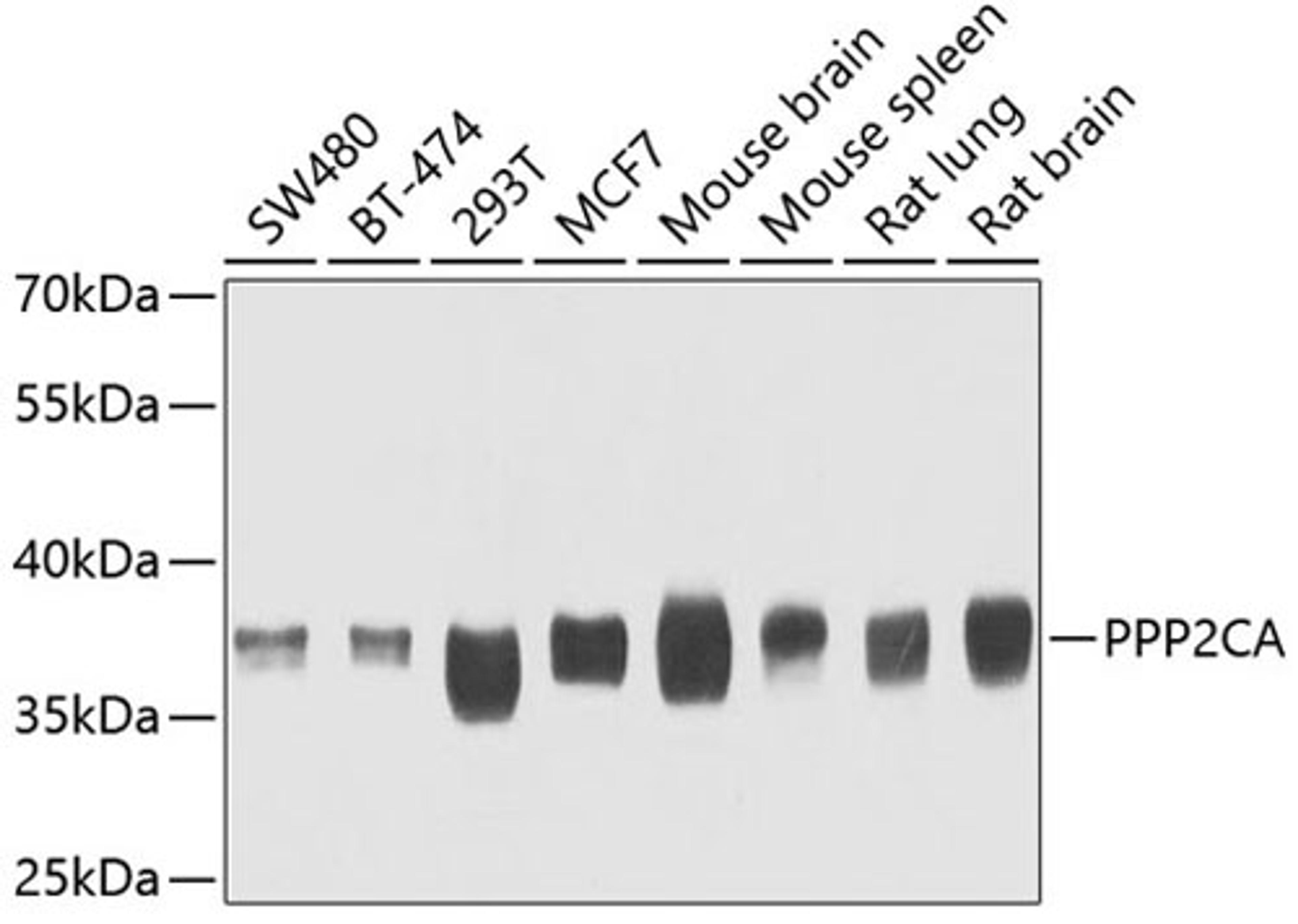 Western blot - PPP2CA antibody (A6702)