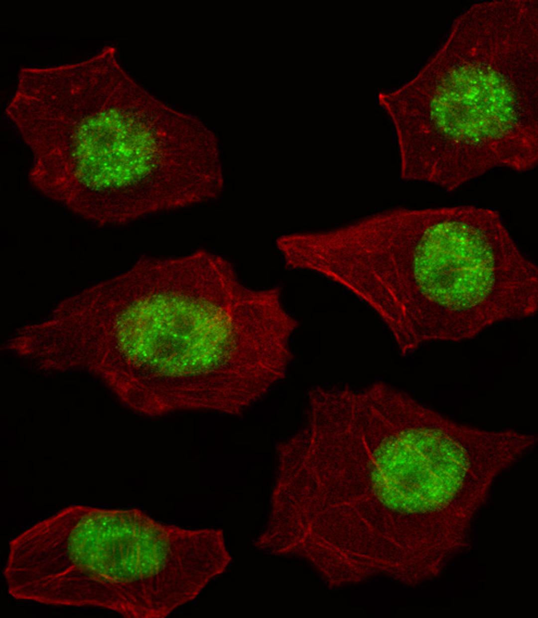 Fluorescent image of A549 cell stained with LMO4 Antibody .A549 cells were fixed with 4% PFA (20 min), permeabilized with Triton X-100 (0.1%, 10 min), then incubated with LMO4 primary antibody (1:25). For secondary antibody, Alexa Fluor 488 conjugated don