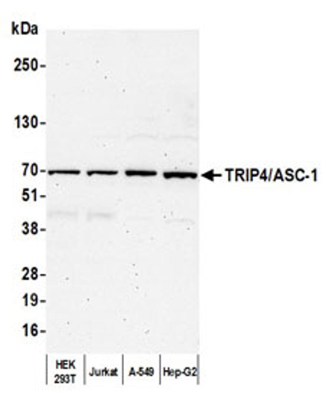 Detection of human TRIP4/ASC-1 by western blot.