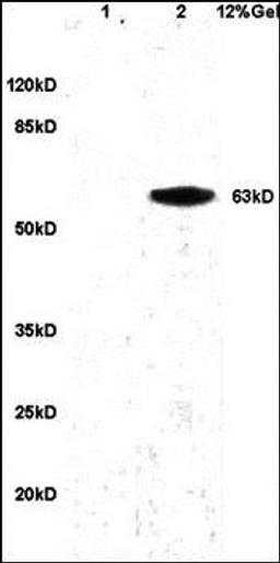 Western blot analysis of human colon carcinoma lysates dilution at:1:200 using PGRN antibody