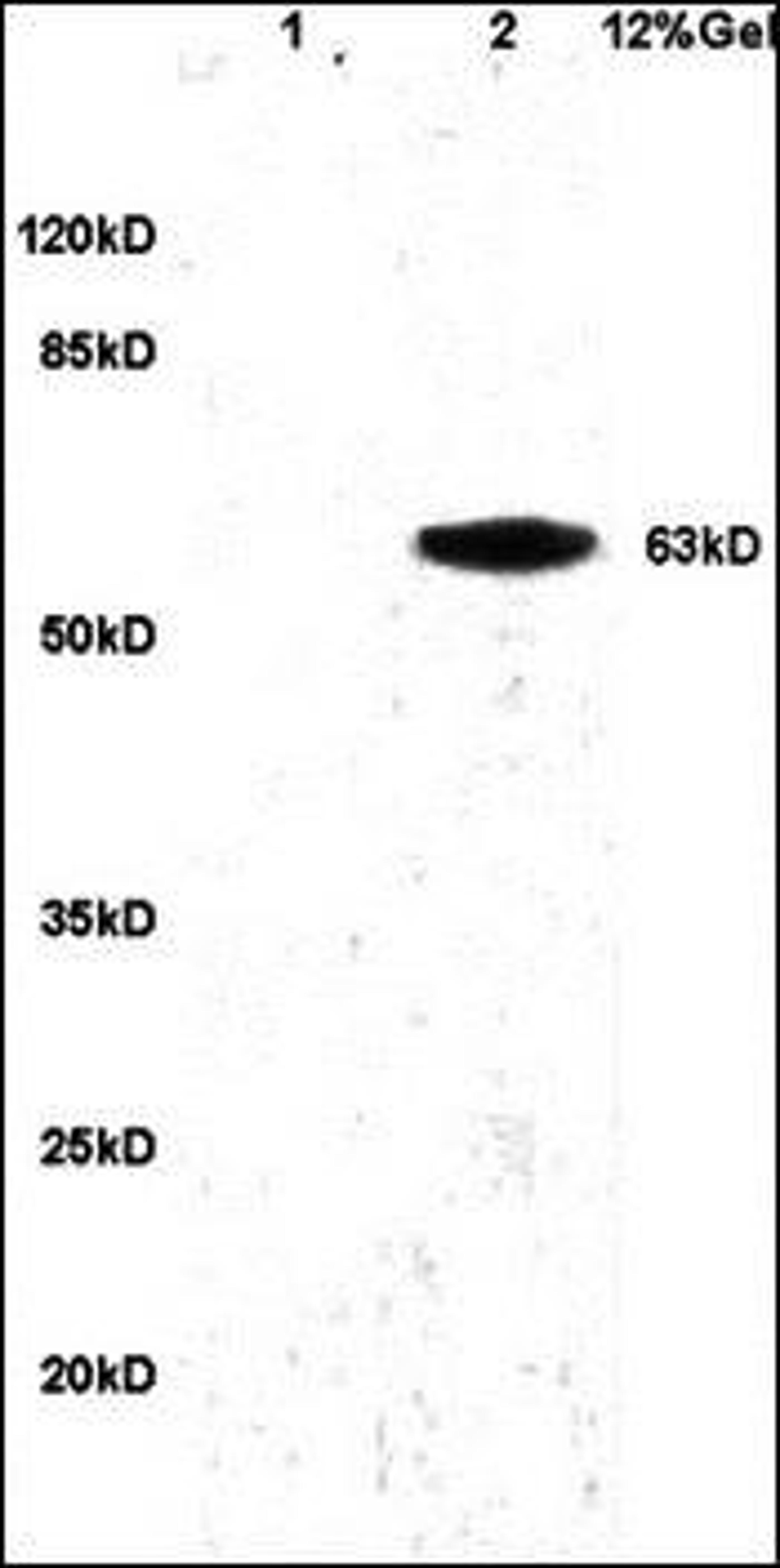 Western blot analysis of human colon carcinoma lysates dilution at:1:200 using PGRN antibody