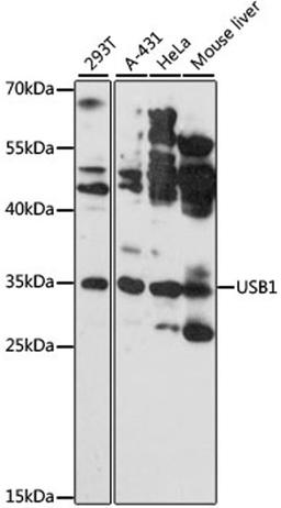 Western blot - USB1 antibody (A13229)