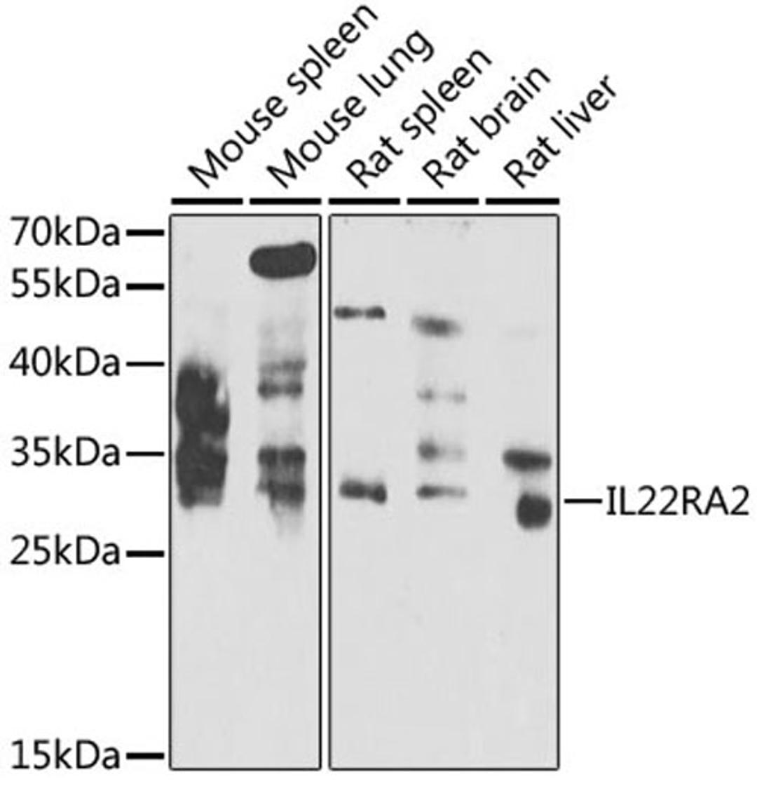 Western blot - IL22RA2 antibody (A7145)