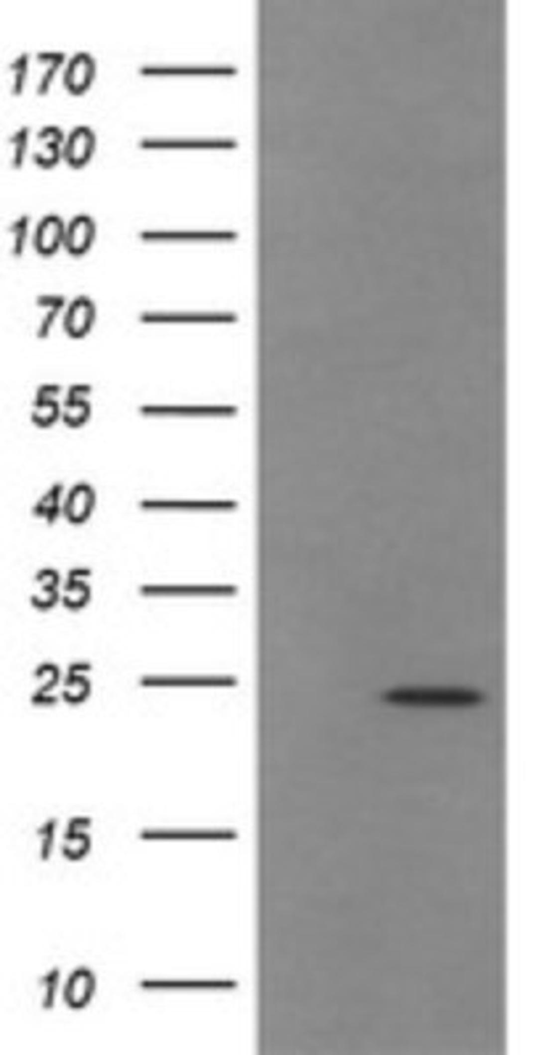 Western Blot: TRAPPC4 Antibody (2G8) [NBP2-46204] - Analysis of HEK293T cells were transfected with the pCMV6-ENTRY control (Left lane) or pCMV6-ENTRY TRAPPC4.