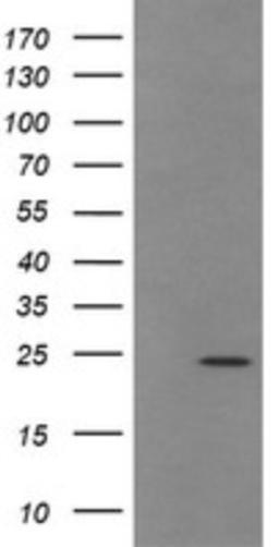 Western Blot: TRAPPC4 Antibody (2G8) [NBP2-46204] - Analysis of HEK293T cells were transfected with the pCMV6-ENTRY control (Left lane) or pCMV6-ENTRY TRAPPC4.