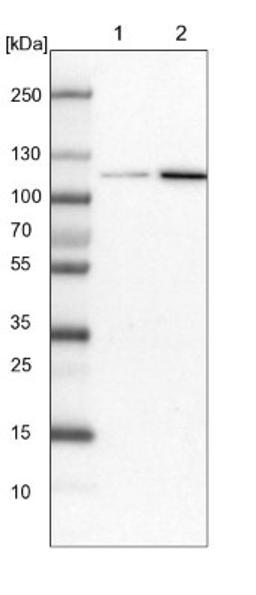 Western Blot: ATP9A Antibody [NBP1-88905] - Lane 1: NIH-3T3 cell lysate (Mouse embryonic fibroblast cells)<br/>Lane 2: NBT-II cell lysate (Rat Wistar bladder tumour cells)