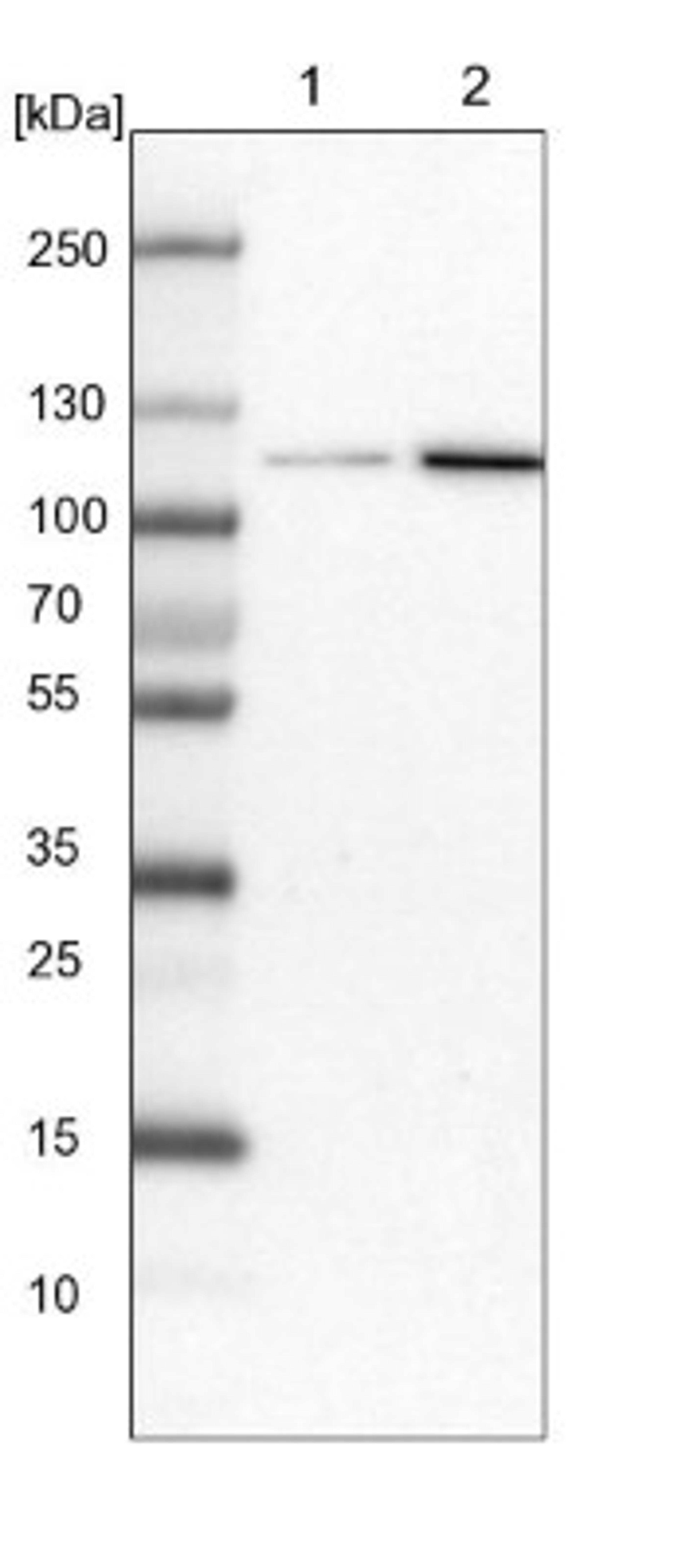 Western Blot: ATP9A Antibody [NBP1-88905] - Lane 1: NIH-3T3 cell lysate (Mouse embryonic fibroblast cells)<br/>Lane 2: NBT-II cell lysate (Rat Wistar bladder tumour cells)