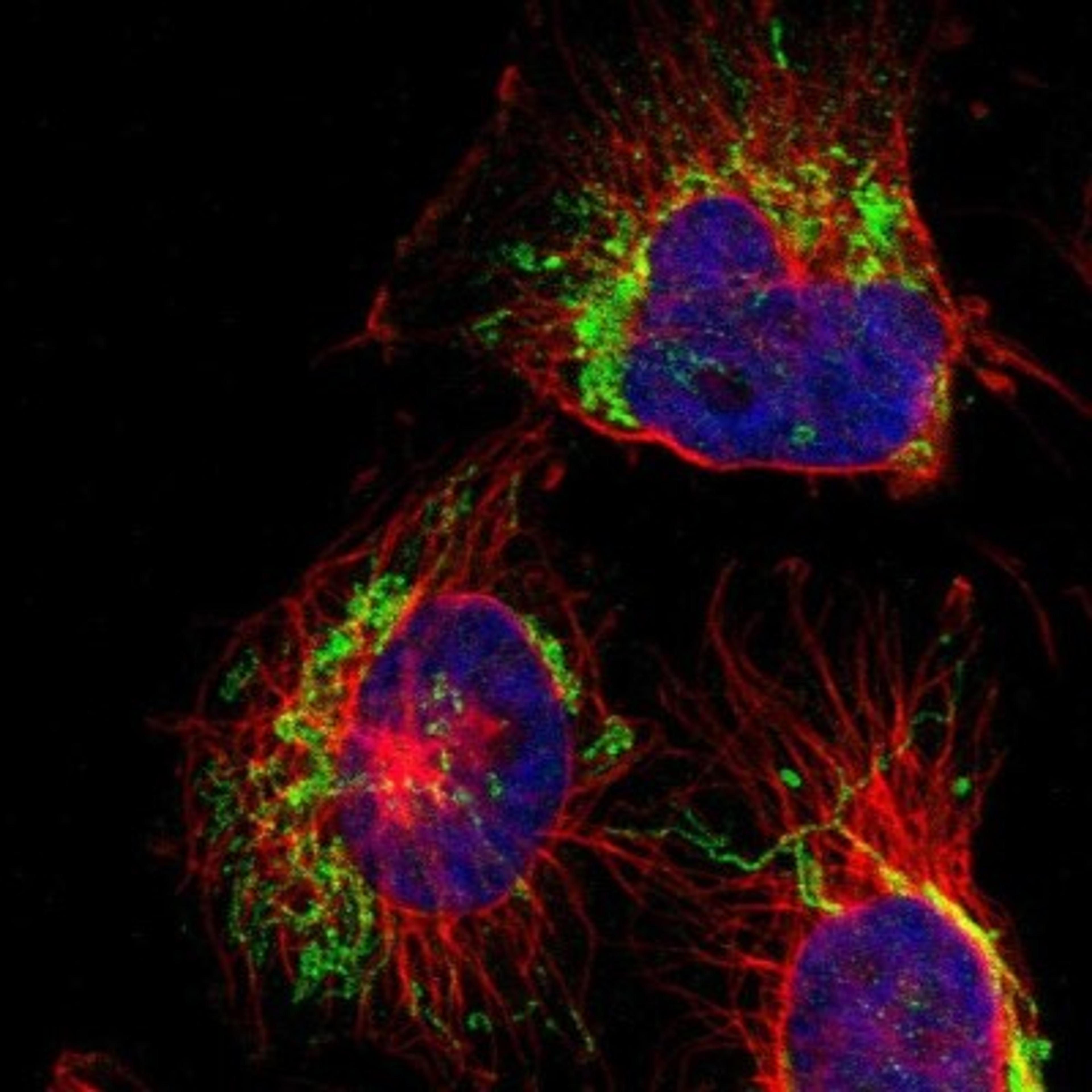 Immunocytochemistry/Immunofluorescence: C6orf170 Antibody [NBP1-90777] - Staining of human cell line U-251MG shows positivity in mitochondria.