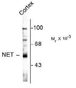 Western Blot: SLC6A2/NET/Noradrenaline transporter Antibody (NET-05) [NBP1-28665] - Rat cortex homogenate.