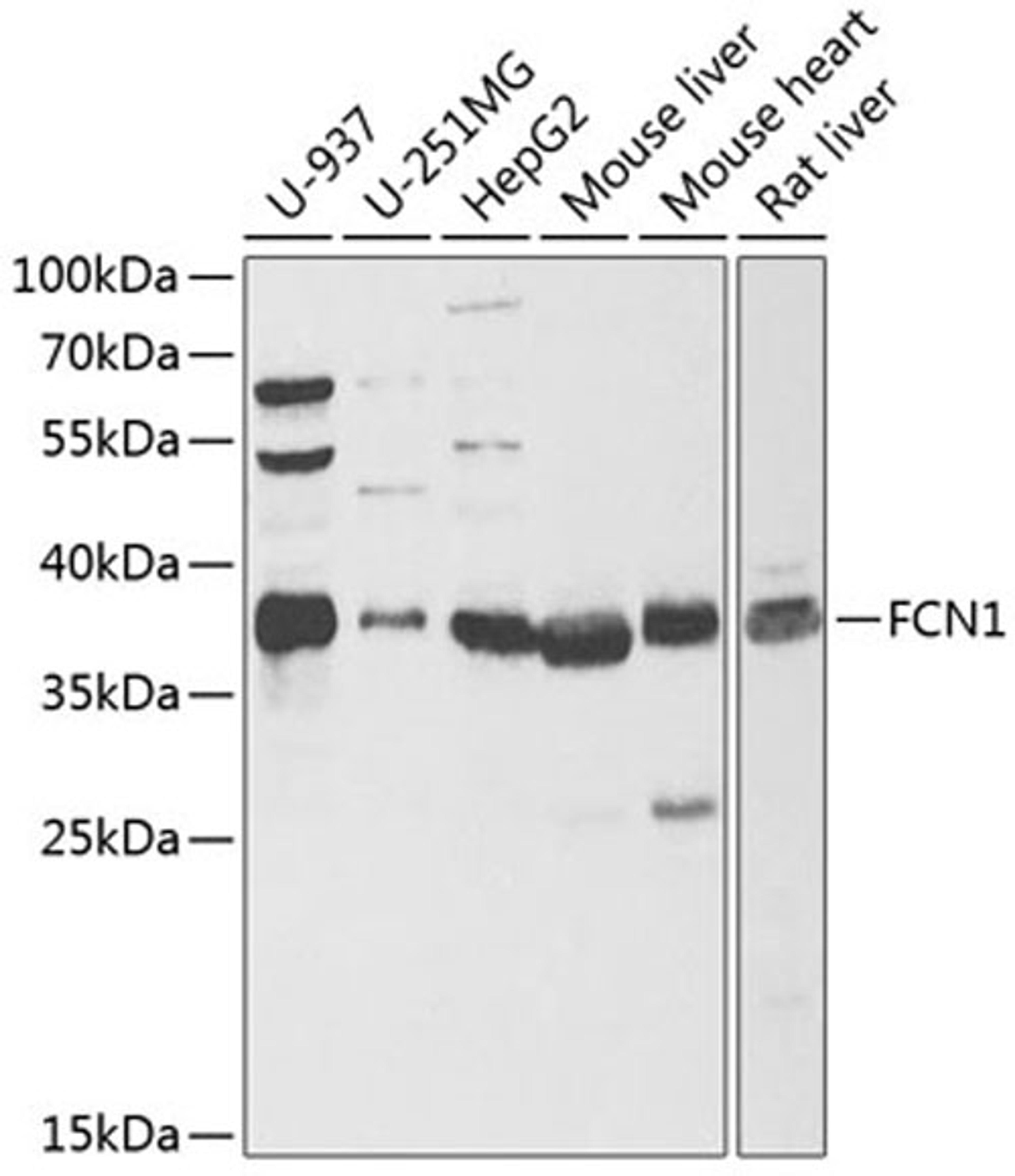 Western blot - FCN1 antibody (A6587)