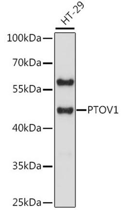 Western blot - PTOV1 antibody (A16126)