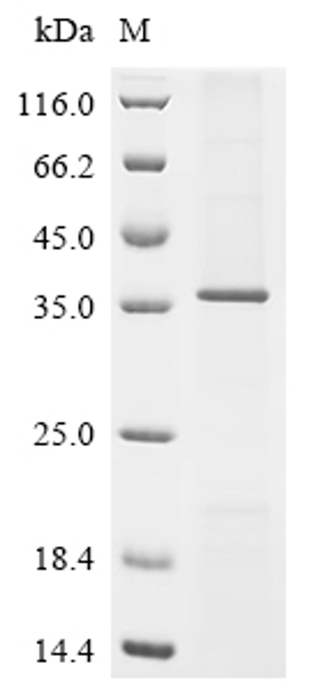 (Tris-Glycine gel) Discontinuous SDS-PAGE (reduced) with 5% enrichment gel and 15% separation gel.