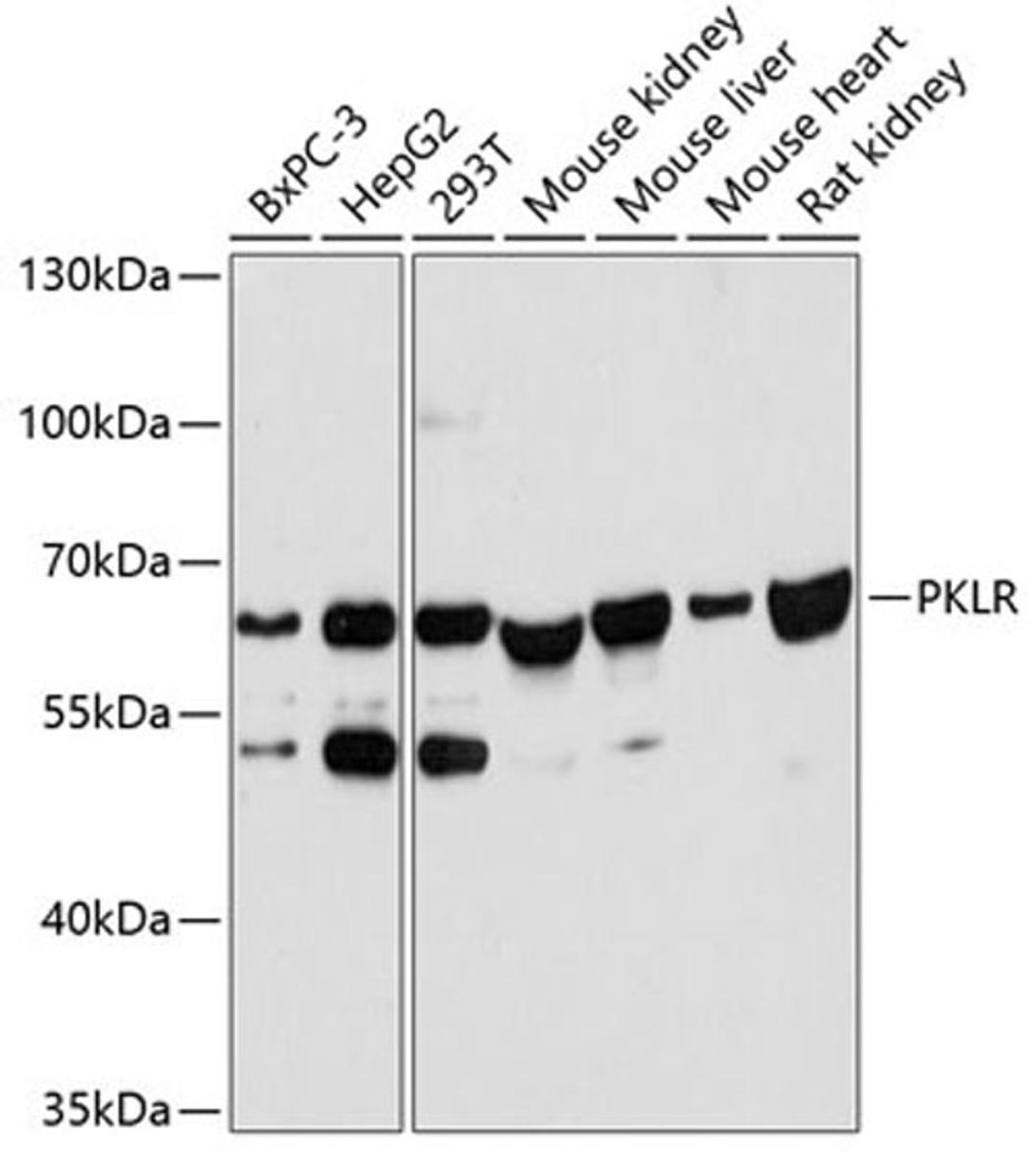 Western blot - PKLR antibody (A12084)