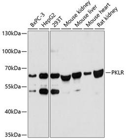 Western blot - PKLR antibody (A12084)