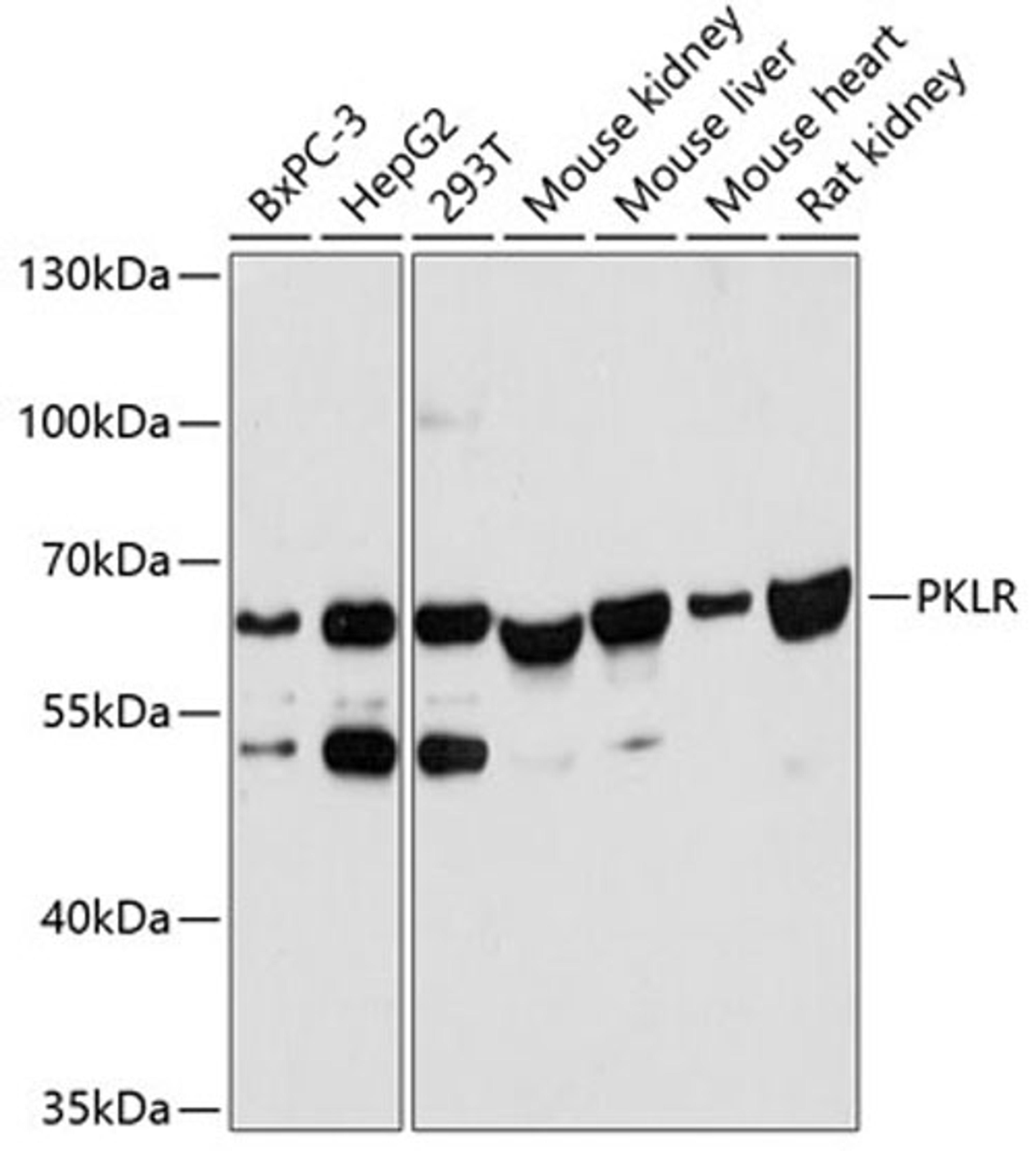 Western blot - PKLR antibody (A12084)