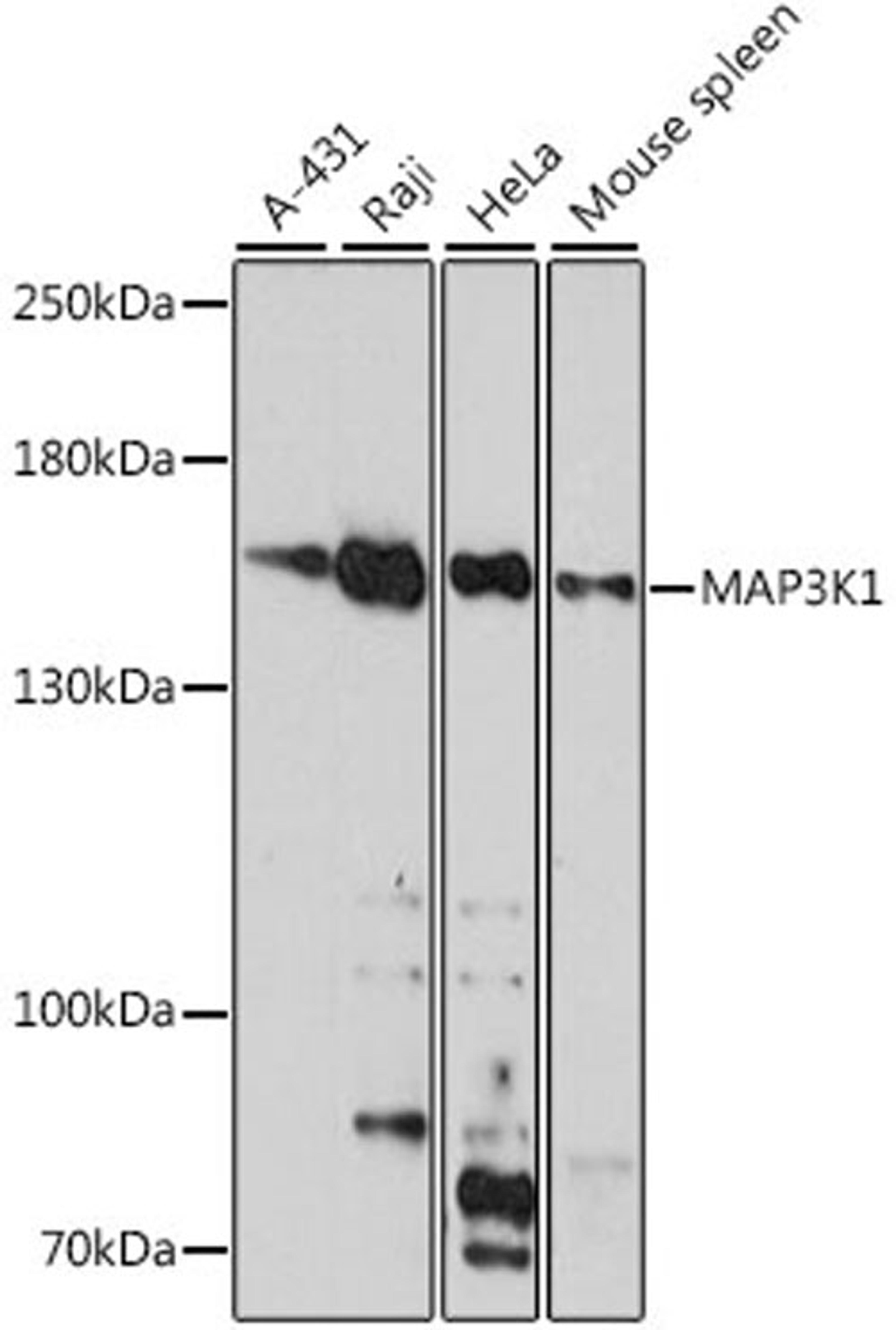 Western blot - MAP3K1 antibody (A16057)