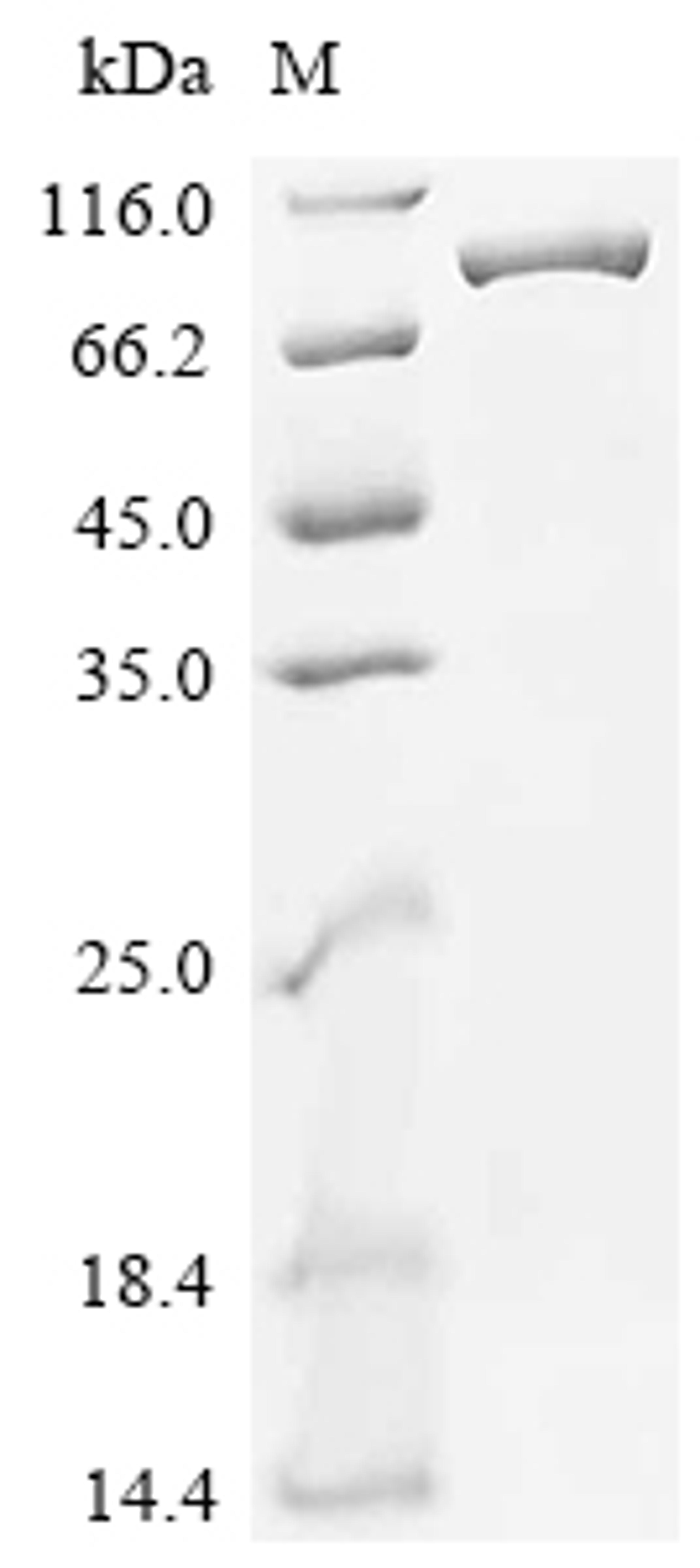 (Tris-Glycine gel) Discontinuous SDS-PAGE (reduced) with 5% enrichment gel and 15% separation gel.