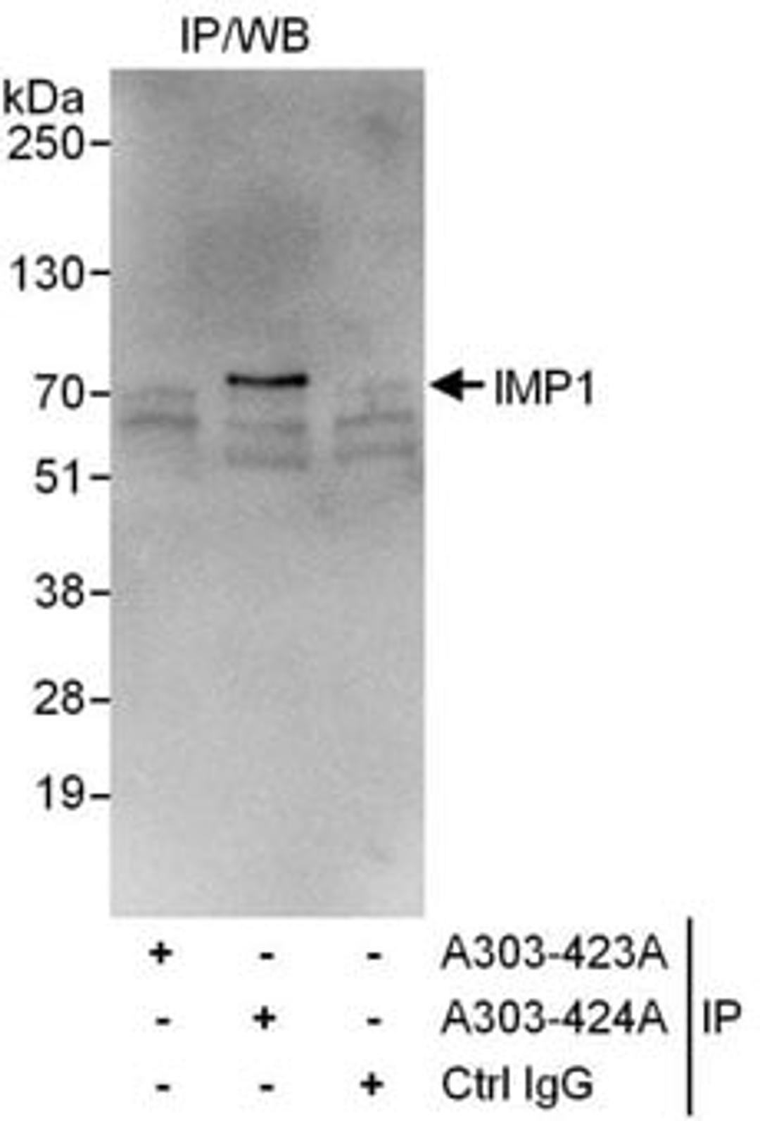 Detection of human IMP1 by western blot of immunoprecipitates.