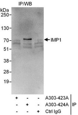 Detection of human IMP1 by western blot of immunoprecipitates.