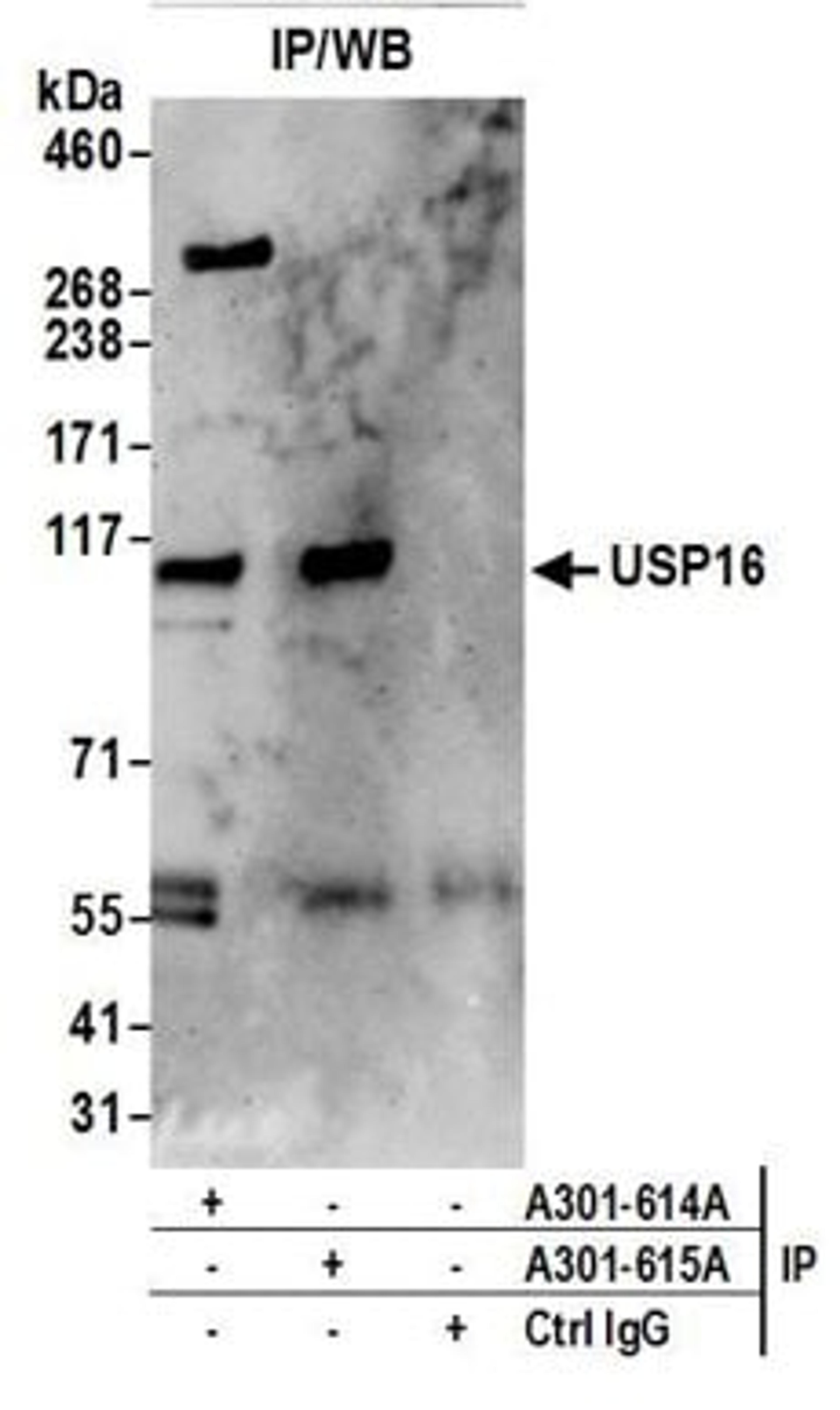 Detection of human USP16 by western blot of immunoprecipitates.