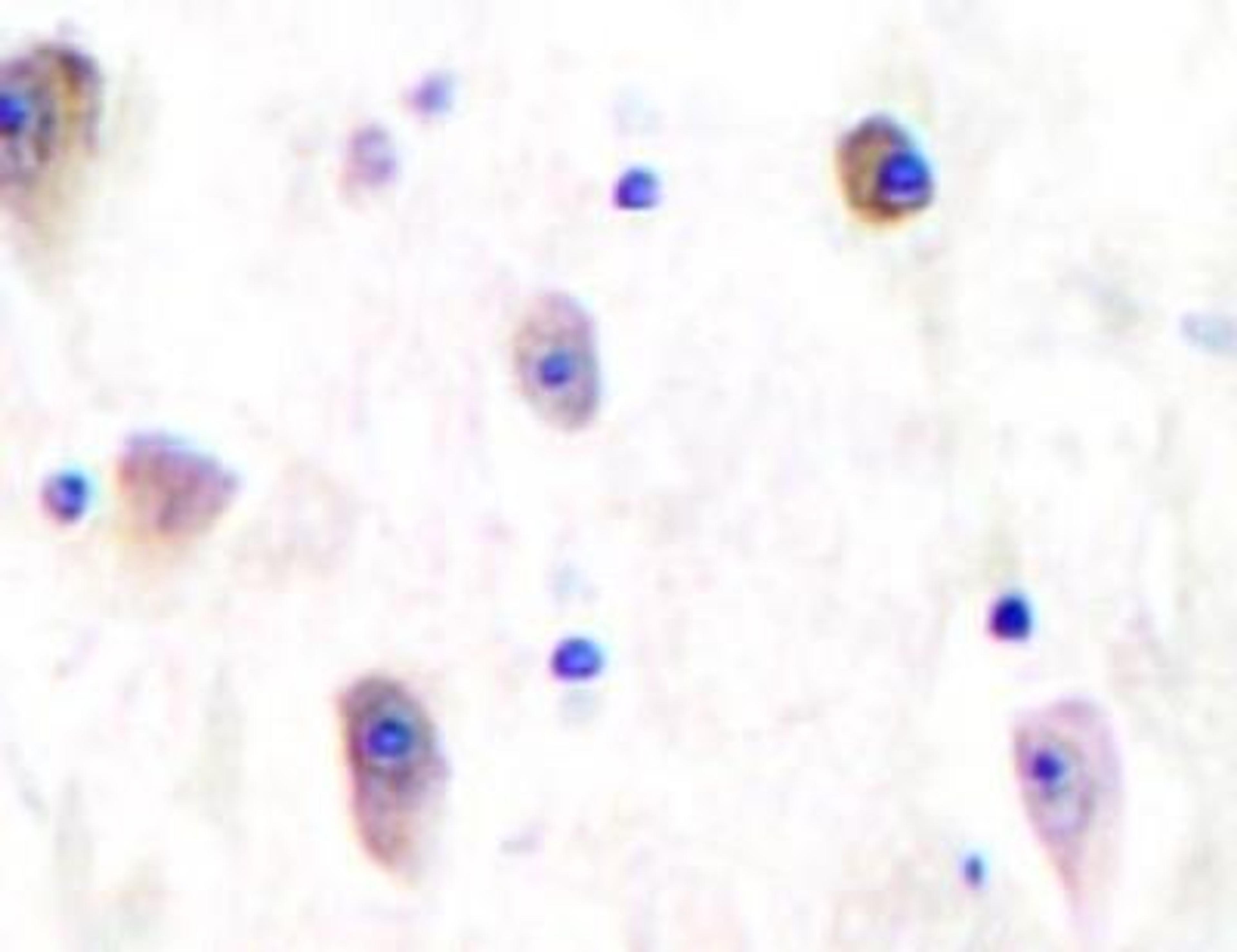 Immunohistochemistry-Paraffin: GluR5/GRIK1 Antibody [NB100-91785] - Glutamate Receptor 5 Antibody [NB100-91785] - Paraffin-embedded human brain tissue.