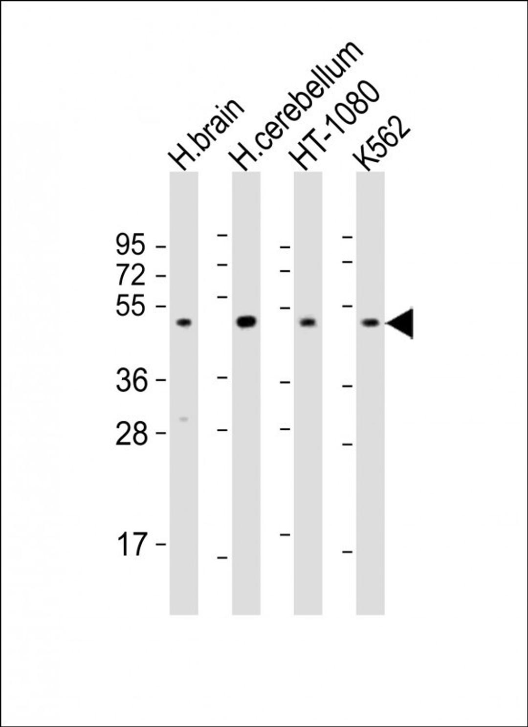 Western Blot at 1:2000 dilution Lane 1: human brain lysate Lane 2: human cerebellum lysate Lane 3: HT-1080 whole cell lysate Lane 4: K562 whole cell lysate Lysates/proteins at 20 ug per lane.