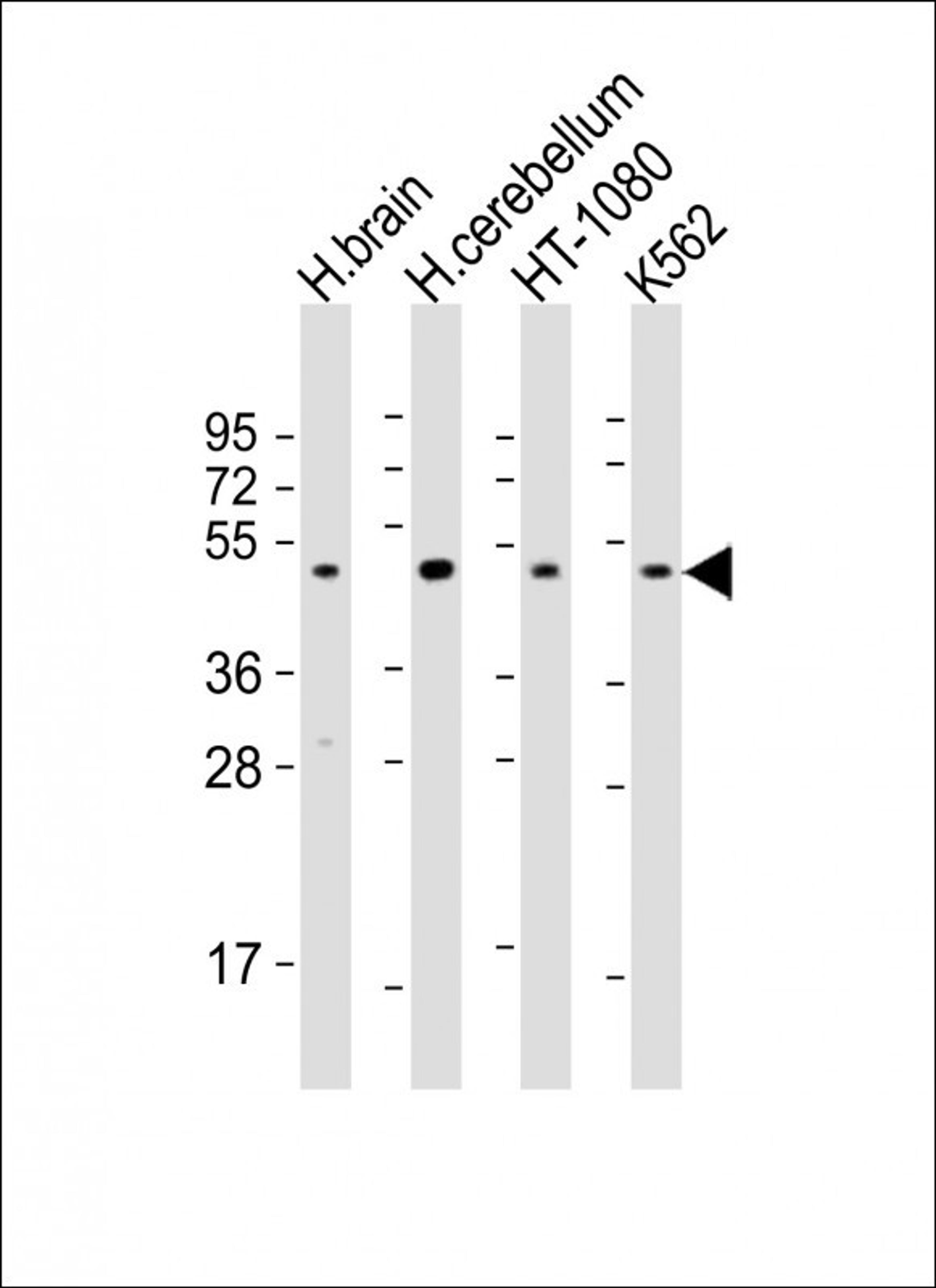 Western Blot at 1:2000 dilution Lane 1: human brain lysate Lane 2: human cerebellum lysate Lane 3: HT-1080 whole cell lysate Lane 4: K562 whole cell lysate Lysates/proteins at 20 ug per lane.