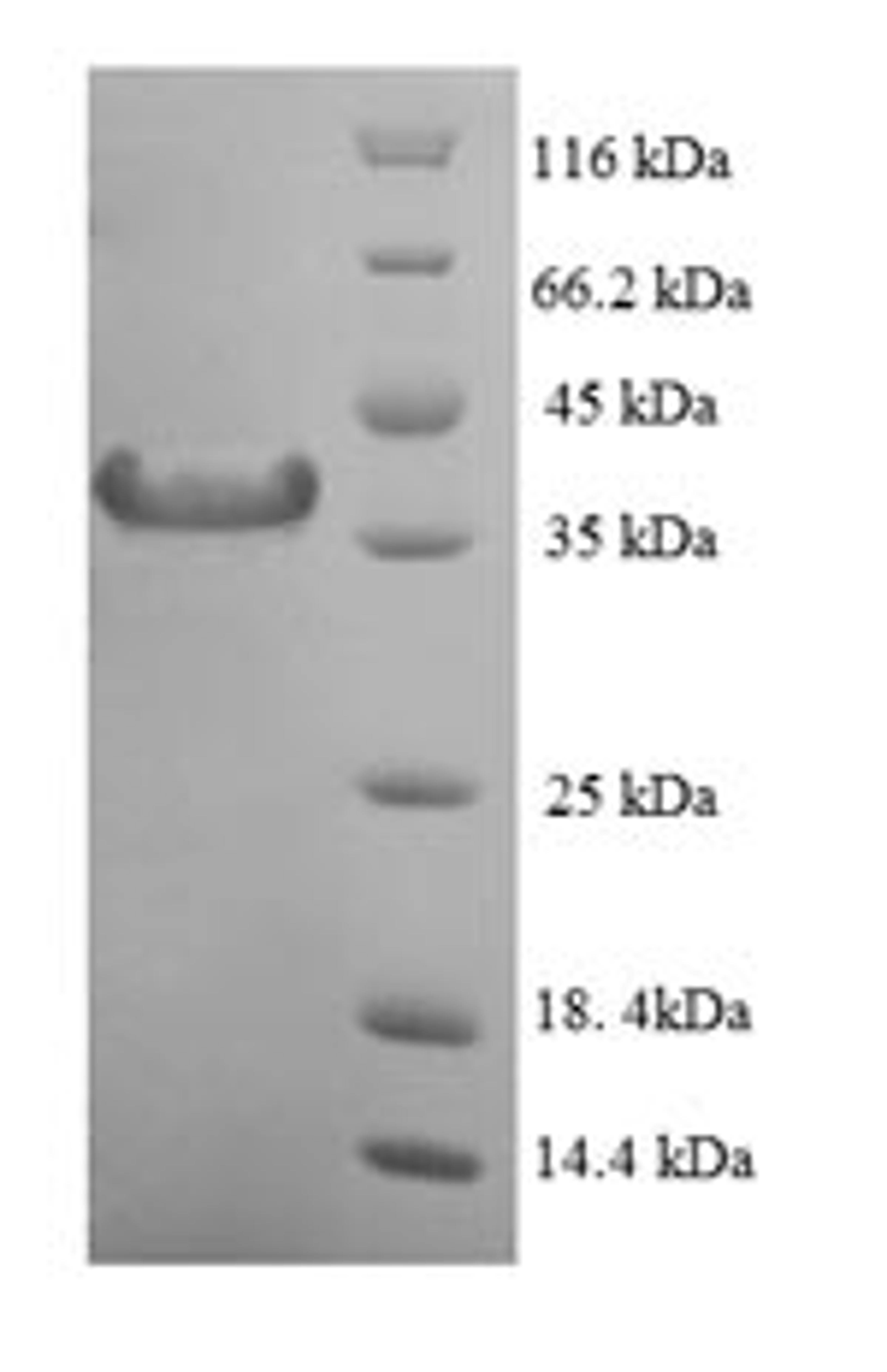 (Tris-Glycine gel) Discontinuous SDS-PAGE (reduced) with 5% enrichment gel and 15% separation gel.